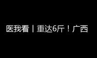 医我看丨重达6斤	！广西女子乳腺肿瘤2年疯长至篮球大，医生提醒：这些情况务必重视