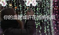 你的血管或许在悄悄长斑！这样做�，“斑块”可能缩小→