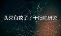 头秃有救了	？干细胞研究阐明压力如何影响毛发生长