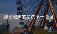 脖子黑黑的总洗不干净可能是病了，这些疾病信号赶紧自查